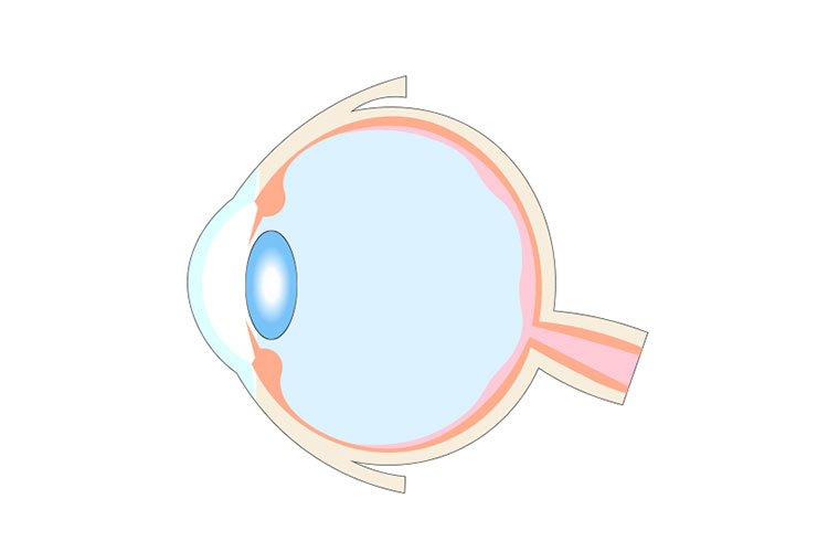 ぶどう膜炎の写真